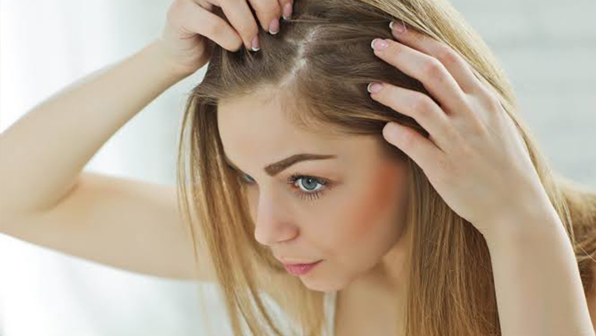 Kadınlara Saç Ekimi Yapılır Mı?