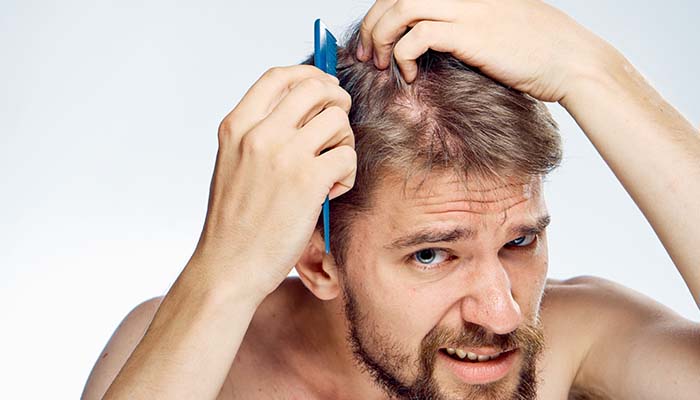 Saç Ekiminde En Sık Karşılaşılan Hatalar