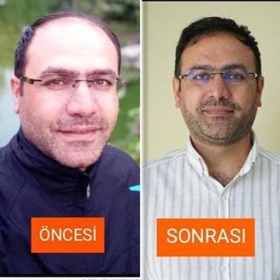 ÖNCESİ SONRASI